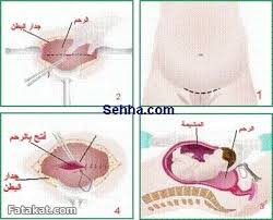 افرازات مخاطيه بيضاء في الشهر التاسع Unnamed File 744