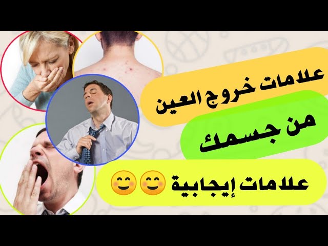 علامات خروج العين