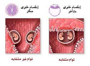 هل كبر حجم البويضه يساعد على حمل التوائم