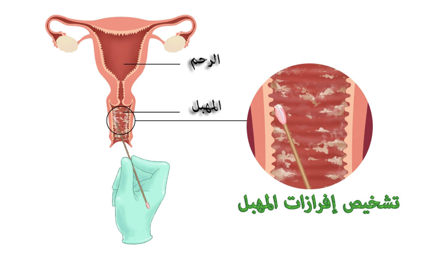 افرازات كريمية بيضاء وقت التبويض ساعدوني 2058