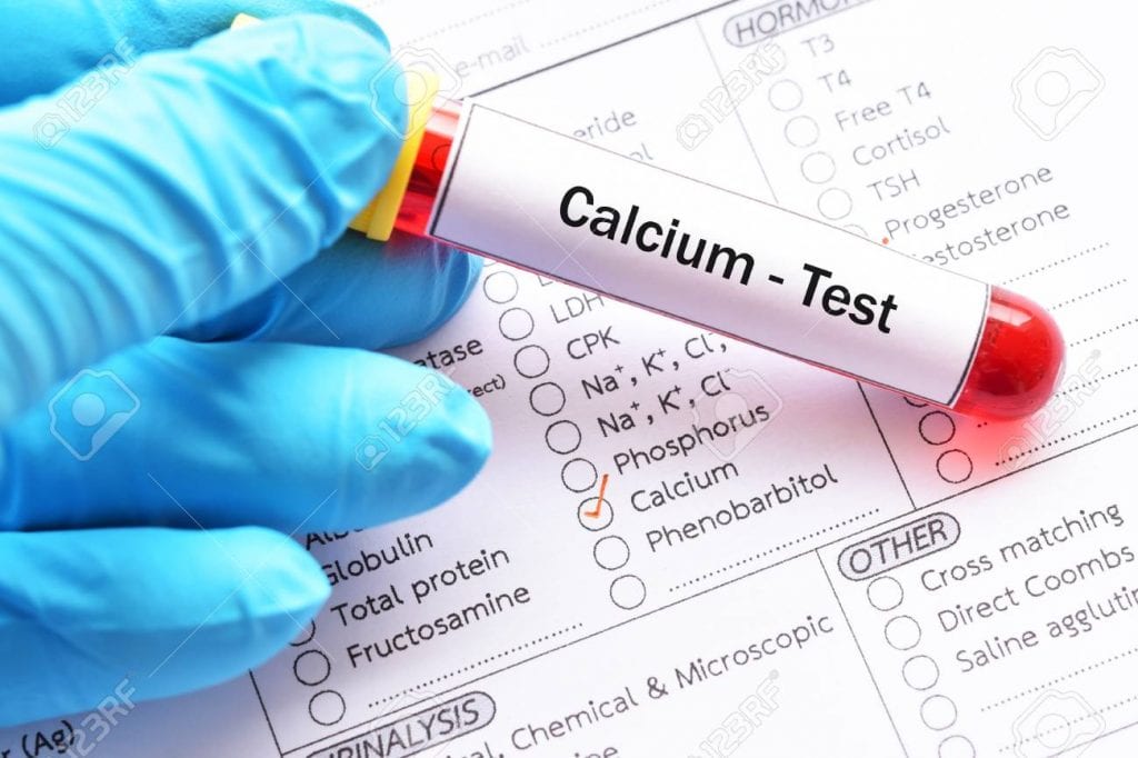 ماهو المعدل الطبيعي للكالسيوم في الجسم-افضل موع كالسيوم ع الاطلاق 1032 1