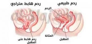 كيف اعرف ان رحمي نازل مالعلامات وكيف طريقه التمريخ للي جربو ارجو المساعده