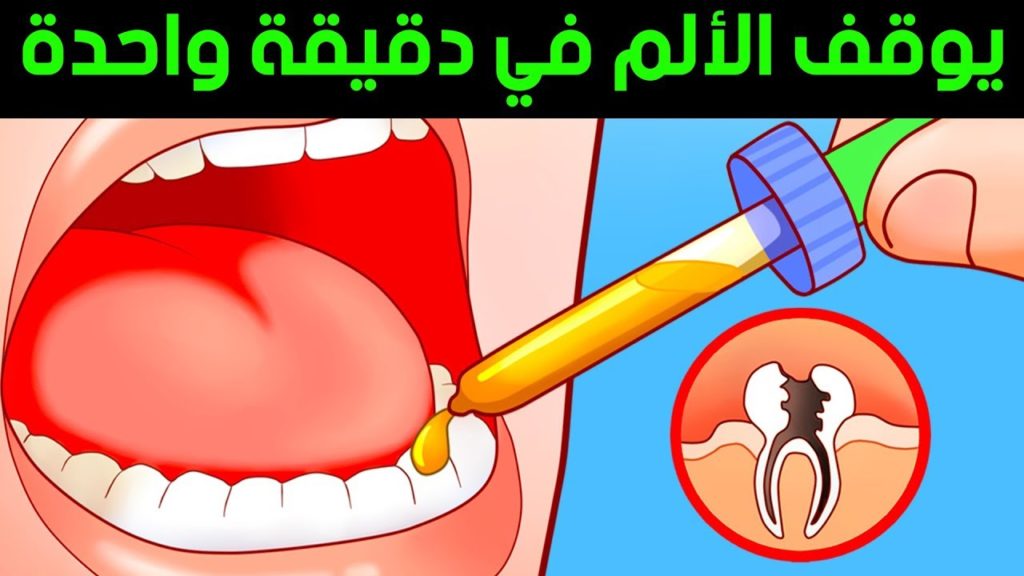 شنو علاج التهاب عصب الضرس واانتفاخ الخد ولو موقت , علاجات منزلية لعلاج التهابات عصب الاسنان