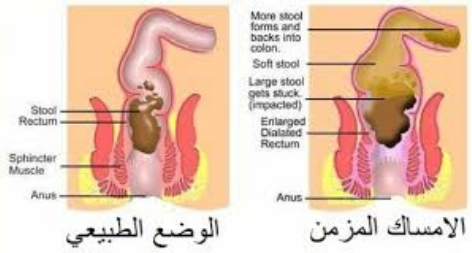 بمووت عندي امساك 921