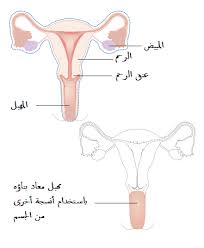 الدم المتجمد في الرحم كيف اتخلص منه